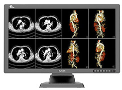 Diagnostic medical monitor JUSHA-C42E