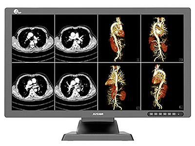 Color Diagnostic Display JUSHA-C42E with dual screen