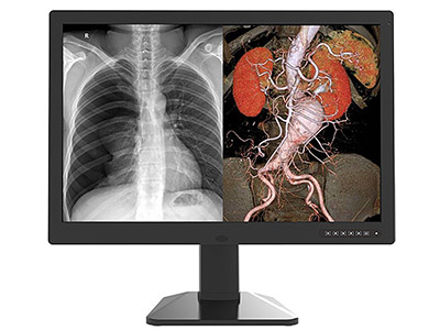 Color Diagnostic Display JUSHA-C61 with dual screen