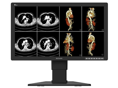 Color Diagnostic Medical Monitor JUSHA-CGA-C42E