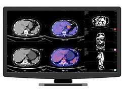 Diagnostic medical monitor JUSHA-CR22