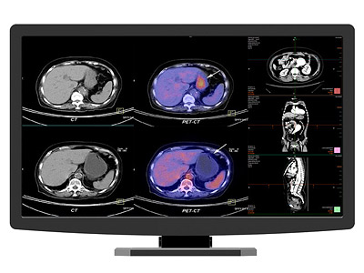 Color Diagnostic Medical Monitor JUSHA-CR22