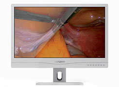 Surgical displays Jusha