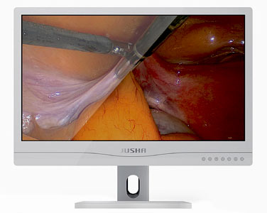 Surgical medical display JUSHA-E240AG