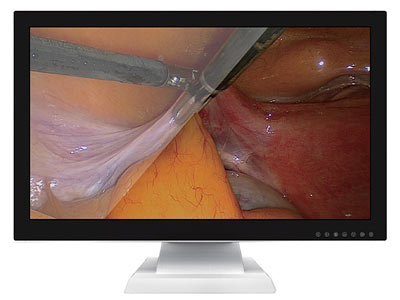 Surgical medical display JUSHA-E260AG