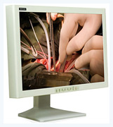 Surgical monitors WIDE
