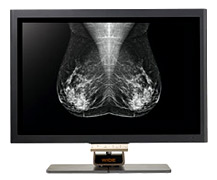 Mammography medical monitors