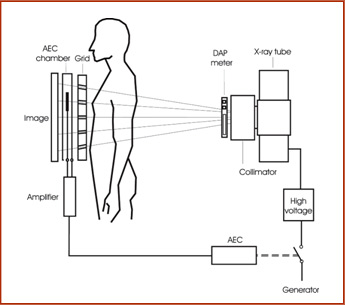 Application scheme, Ionization Chambers AEC Sensor